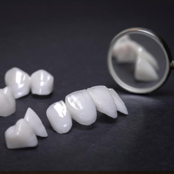 Several white dental crowns and veneers on a tray next to dental mirrors